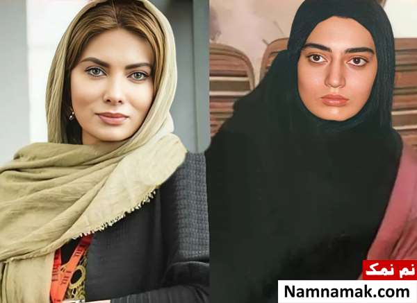 نگار فروزنده قبل از عمل بینی