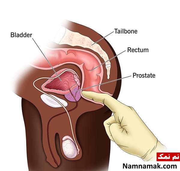 پروستات