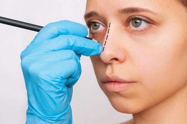 ایا عمل بینی کار درستی است؟