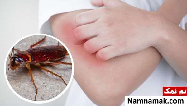انواع حشرات گزنده انواع حشرات گزنده