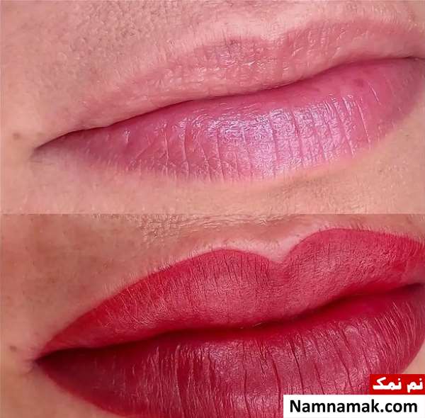 میکروبلیدینگ لب(تاتو لب) چیست؟