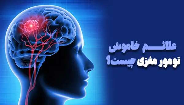علائم خاموش تومور مغزی چیست؟