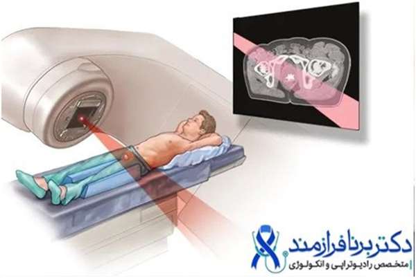آیا زنان هم به سرطان پروستات مبتلا می شوند؟