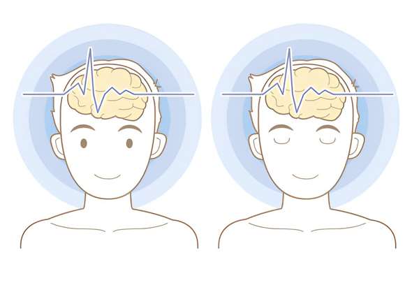 درمان با دستگاه tdcs