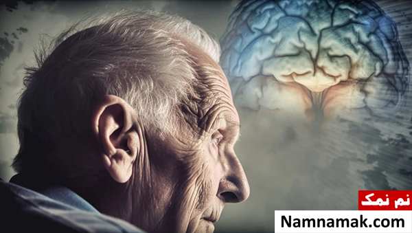 آخرین مرحله آلزایمر چند سال طول می کشد؟