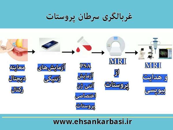 غربالگری سرطان پروستات