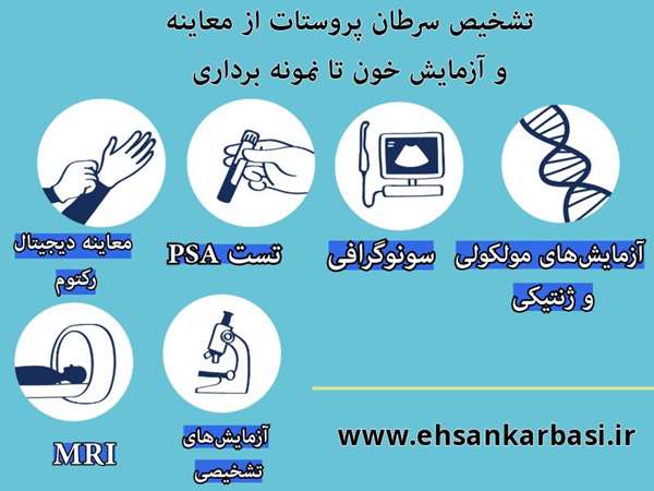 تشخیص سرطان پروستات