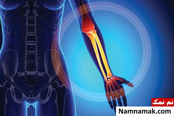 برای پهن شدن استخوان چه بخوریم؟