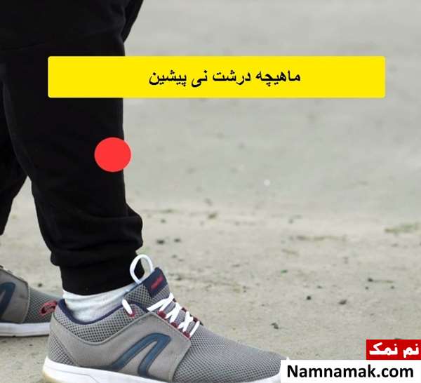 نقاط حساس بدن در دعوا و دفاع شخصی نقاط حساس بدن در دعوا و دفاع شخصی