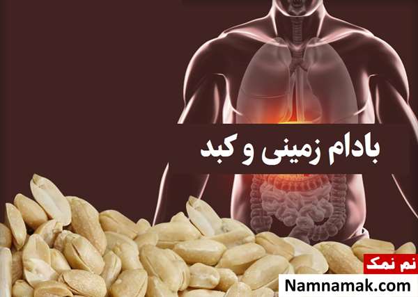 عوارض بادام زمینی برای کبد چرب