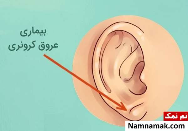 انواع شکل گوش انسان و رازها و شگفتی های آن انواع شکل گوش انسان و رازها و شگفتی های آن