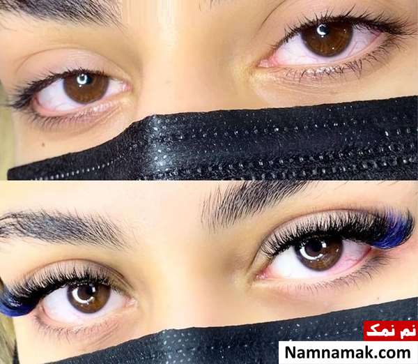 کاشت مژه هیدن و تفاوت آن با اکستنشن کلاسیک کاشت مژه هیدن و تفاوت آن با اکستنشن کلاسیک