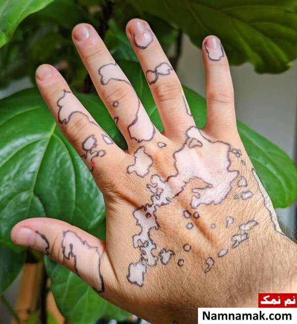 زیباترین و باکلاس ترین بیماری های جهان
