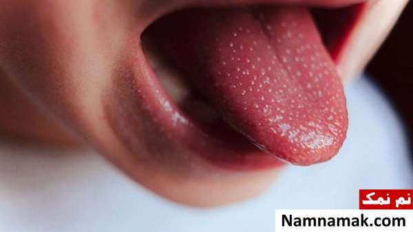 آیا بیماری کاوازاکی خطرناک است و باعث مرگ میشود؟