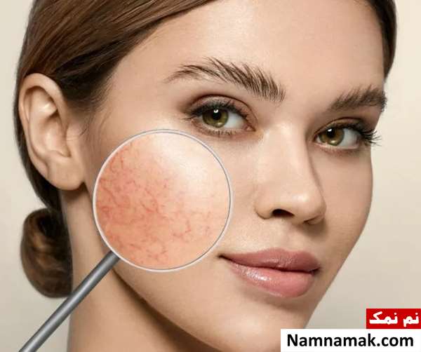 چگونه بفهمیم پوستمان حساس است؟