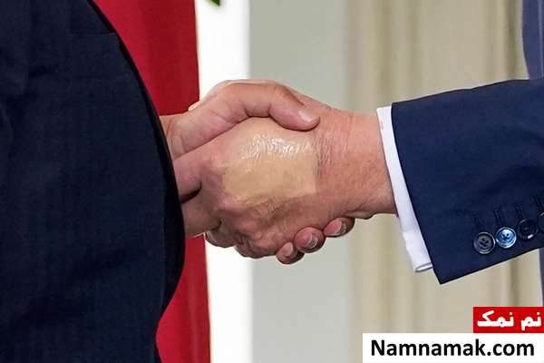 بیماری دونالد ترامپ بیماری دونالد ترامپ