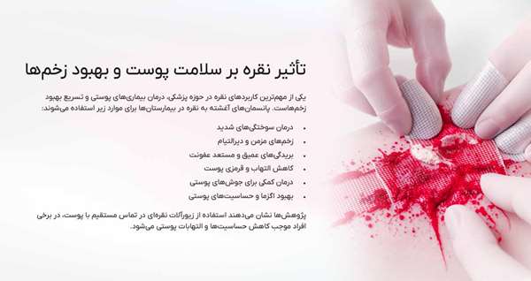 خواص استفاده از نقره بر پوست
