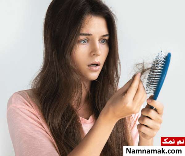 خوراکی باعث ریزش مو