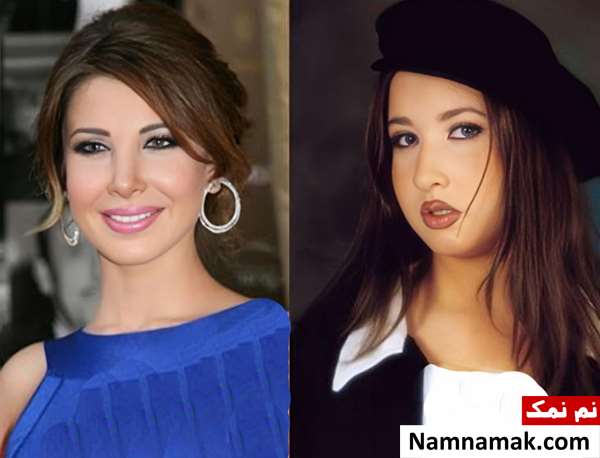 نانسی عجرم قبل از عمل