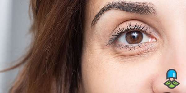 مهم ترین علل پف زیر چشم و کبد