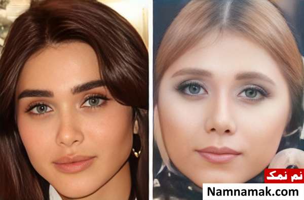 عکس قبل و بعد عمل هیوا امین