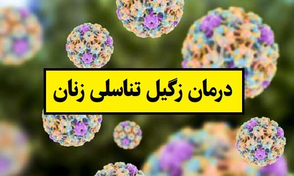درمان زگیل تناسلی زنان در تهران؛ روش های قطعی و ایمن