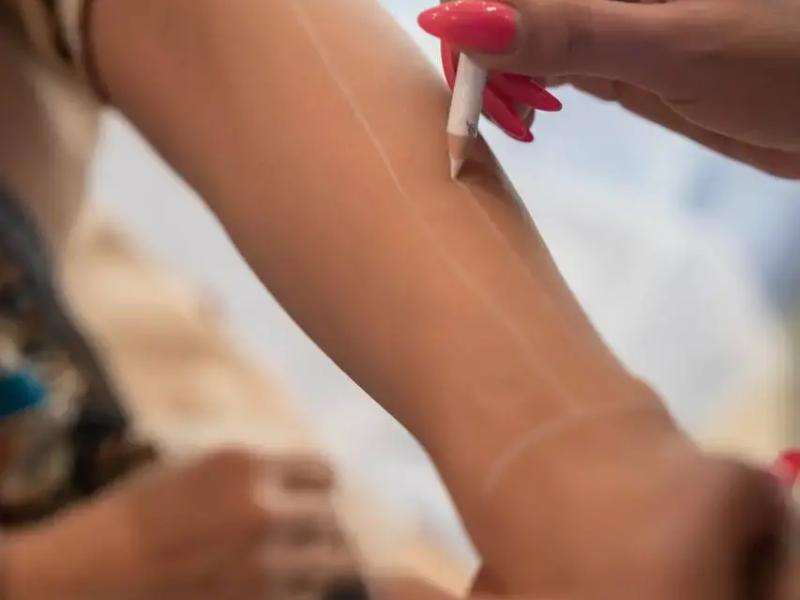 لیزر موهای زائد در مشهد: آیا واقعاً ارزش هزینه را دارد؟ + محاسبه دقیق