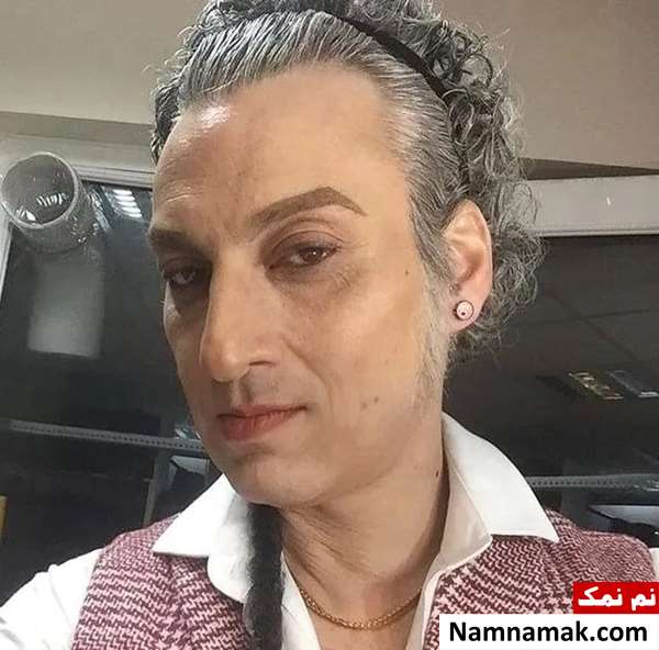 تمام بازیگران زن و مرد ایرانی که بینی خود را عمل کرده اند