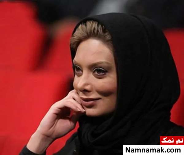 تمام بازیگران زن و مرد ایرانی که بینی خود را عمل کرده اند