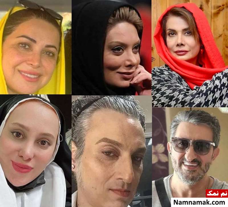 کدام بازیگران زن و مرد ایرانی بینی خود را عمل کرده اند؟
