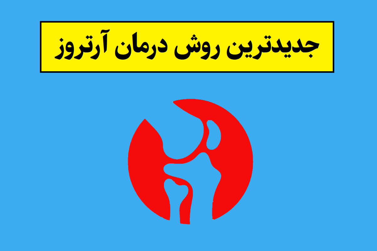 جدیدترین روش درمان آرتروز(2026) که تازه کشف شده