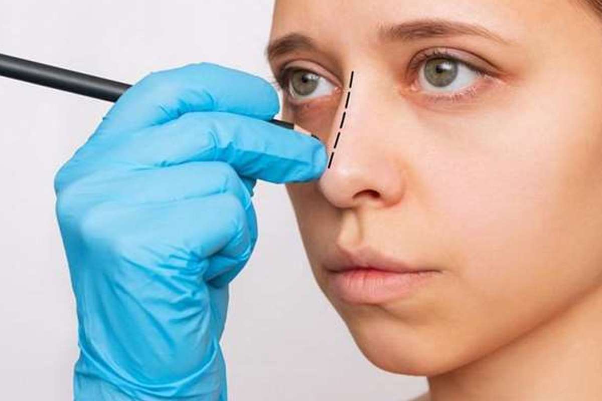 ایا عمل بینی کار درستی است؟