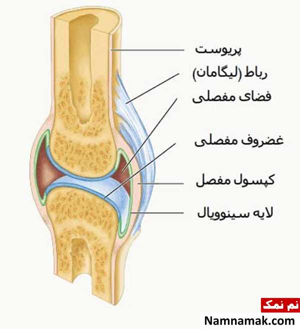 علائم و درمان التهاب مفصل یا آرتریت علائم و درمان التهاب مفصل یا آرتریت