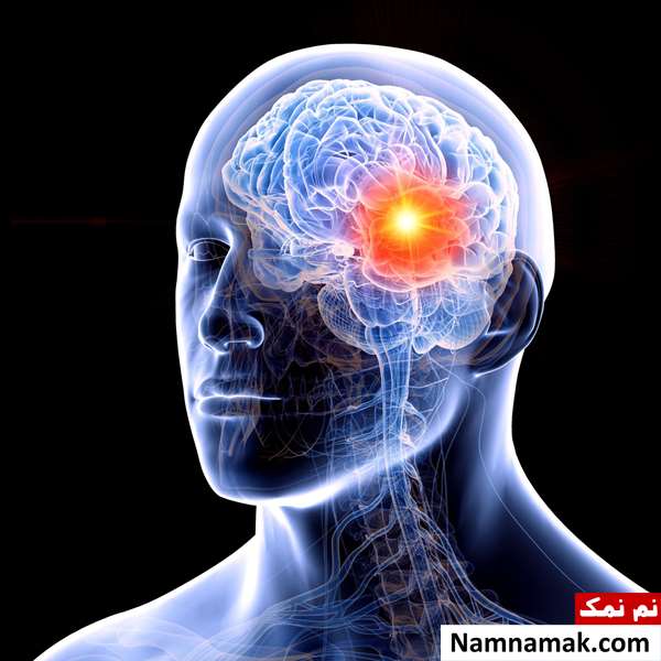 آیا تومور مغزی با دارو درمان می شود؟
