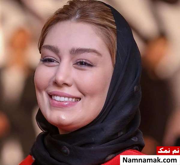 تزریق ژل سحر قریشی قبل از عمل