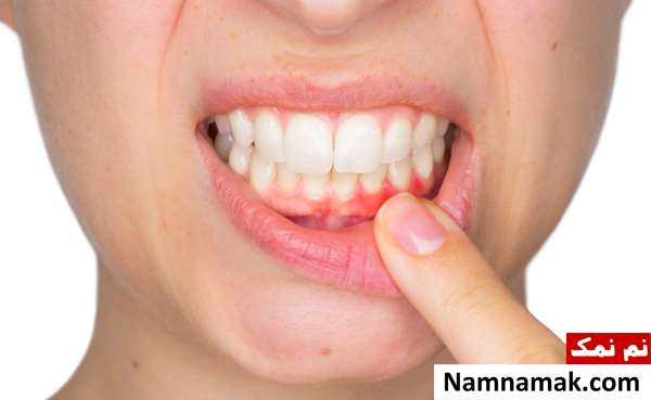 تشخیص بارداری از روی زبان