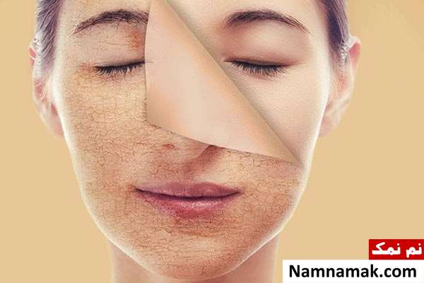 علائم و نشانه های کم آبی بدن