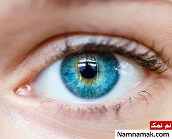تنبلی چشم و آستیگماتیسم تنبلی چشم و آستیگماتیسم