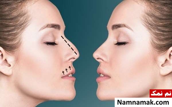 برنامه عمل بینی سه بعدی