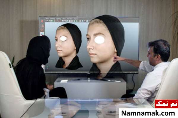 قیمت عمل بینی با قالب کنترلی