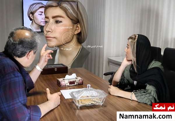قیمت و هزینه اسکن سه بعدی صورت قیمت و هزینه اسکن سه بعدی صورت