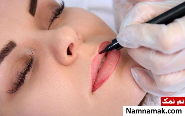تزریق ژل لب بعد از تاتو لب