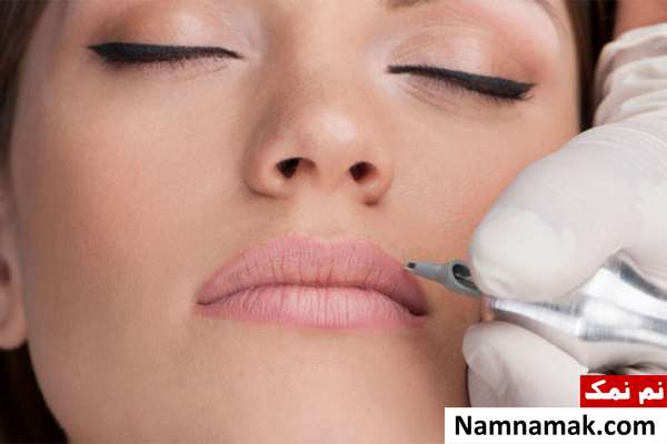 تزریق ژل لب بعد از تاتو لب