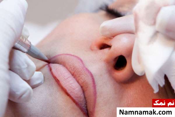 تزریق ژل لب بعد از تاتو لب