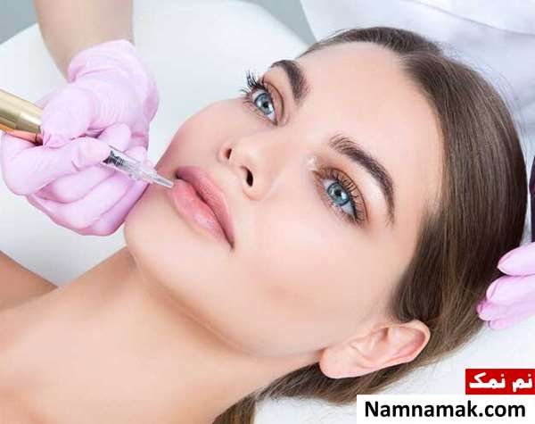 تزریق ژل لب بعد از تاتو لب