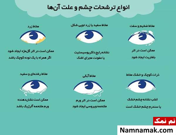 ترشحات چشم بعد از خواب ترشحات چشم بعد از خواب