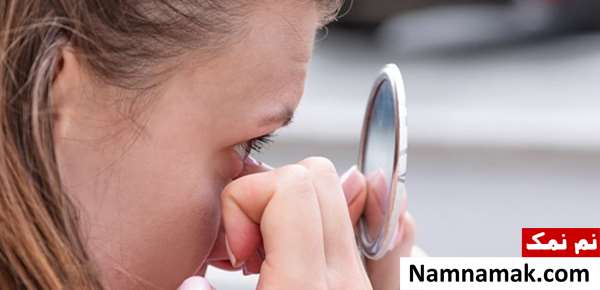 ترشحات چشم بعد از خواب ترشحات چشم بعد از خواب
