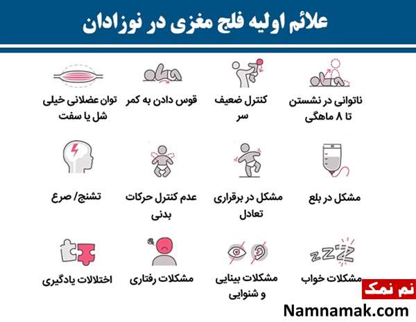 علت خم شدن نوزاد به جلو و دولا شدن نوزاد