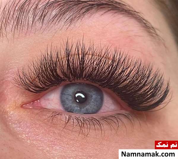 استارتر مژه