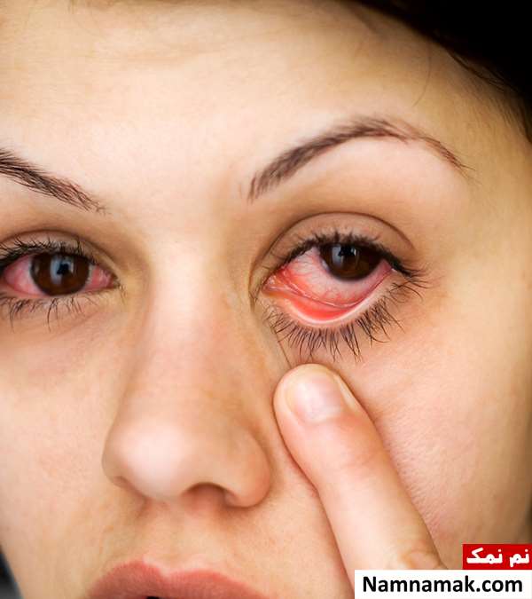 تشخیص بارداری از روی چشم